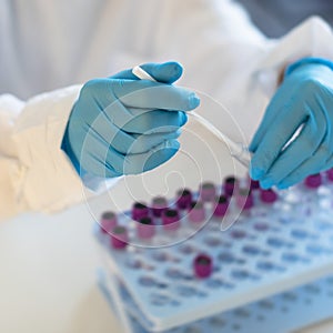 Process of coronavirus testing examination by nurse medic in laboratory lab, COVID-19 swab collection kit, test tube for taking OP