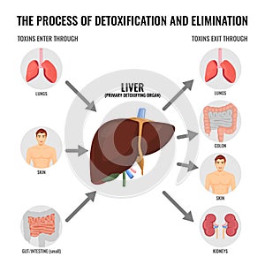 Process of detoxification and elimination cartoon medical poster