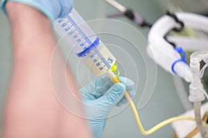 Process of feeding the patient through the tube in critical condition