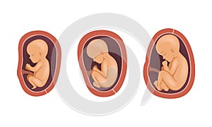 Process of Fetal Development or Embryological Stage Vector Set photo
