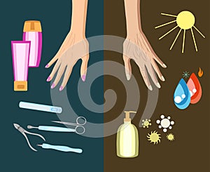 The process of hand skin aging, reason. Vector illustration