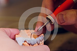 The process of making a dental prosthesis in a dental laboratory.