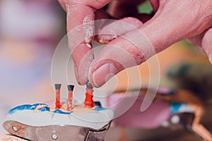 The process of making a dental prosthesis in a dental laboratory.