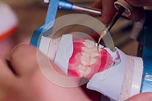 The process of making a dental prosthesis in a dental laboratory.