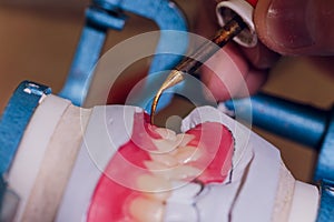 The process of making a dental prosthesis in a dental laboratory.