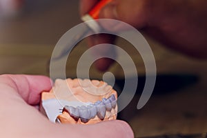 The process of making a dental prosthesis in a dental laboratory.