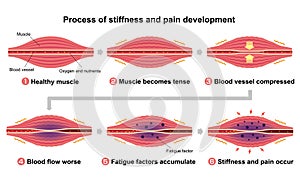 Process of muscle`s stiffness and pain / English