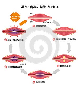 Process of muscle`s stiffness and pain / Japanese