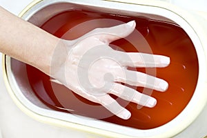 The process of paraffin therapy of a female hand is shot close up