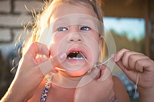 The process of removing a baby tooth using a thread