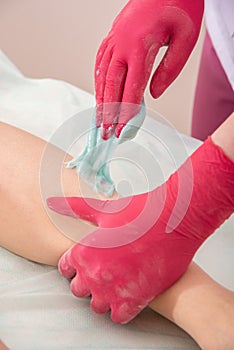 The process of sugar depilation. Master in medical gloves puts a blue paste on the client`s leg