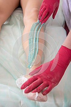 The process of sugar depilation. Master in medical gloves puts a blue paste on the client`s leg