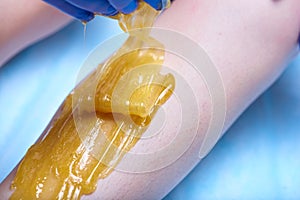 A process of sugaring depilation