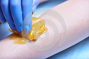 A process of sugaring depilation