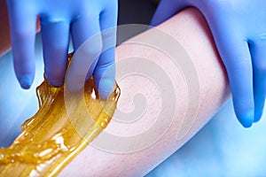 A process of sugaring depilation