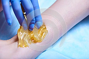 A process of sugaring depilation