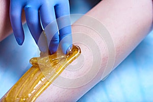 A process of sugaring depilation