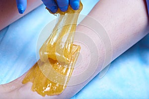 A process of sugaring depilation