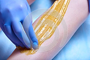 A process of sugaring depilation