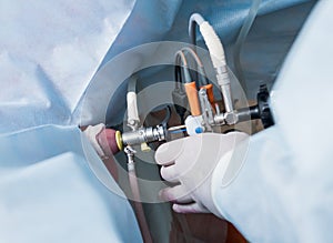 Process of urological surgery operation using laparoscopic equipment.