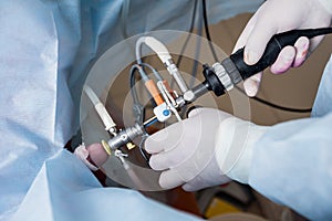 Process of urological surgery operation using laparoscopic equipment.