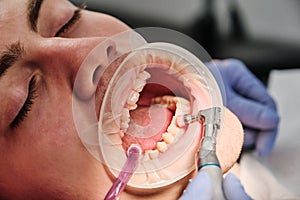 Process of using stomatological brush as a stage of professional dental cleaning procedure in clinic close up