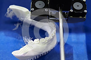 Production of dental prostheses. Printing on a 3D printer