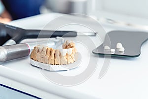 Production of dental veneers and crowns from medical porcelain and ceramics.