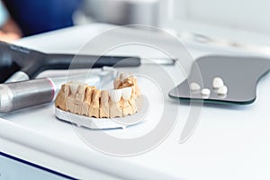 Production of dental veneers and crowns from medical porcelain and ceramics. photo