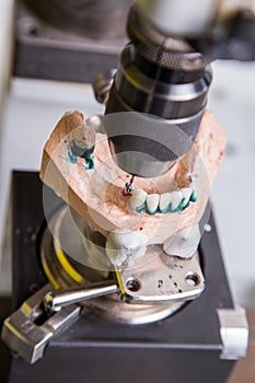 Production dentures drill in action