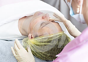 A professional cosmetologist applies a chemical peeling solution to the patient on the skin of the face with the help of hands in