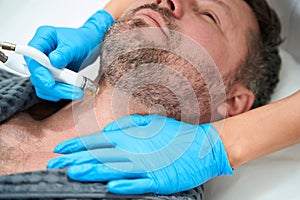 Professional cosmetologist performs microdermabrasion on a middle-aged patient