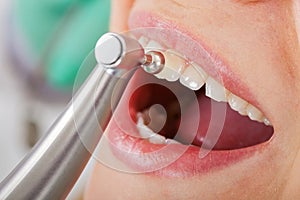 Professional dental cleaning