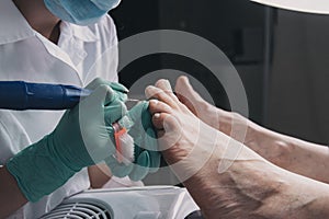 Professional hardware pedicure using electric machine