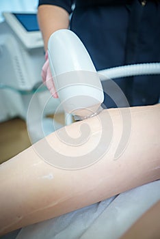 Professional Laser Hair Removal for Smooth Legs at a Salon