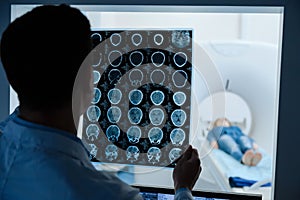 Professional male oncologist looking at the MRI scan image