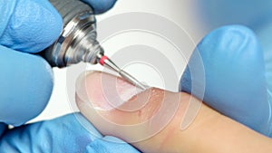 Professional of manicure cures the fingers of the client by apparatus. Close up