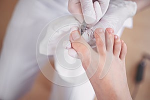 Professional medical pedicure procedure close up using nail clippers instrument. Patient visiting chiropodist podiatrist. Foot