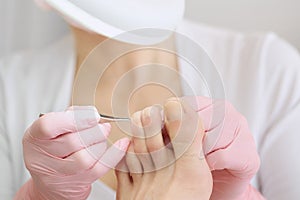 Professional pedicure using special nail intrument.Patient visiting podiatrist.Medical pedicure procedure using tweezer photo