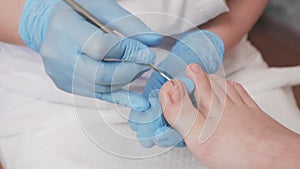 Professional podologist does a pedicure for the client's foot, cleaning the nails with a double-sided curette. Close