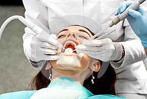 Professional teeth cleaning