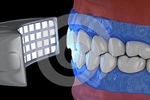 Professional teeth whitening. Gel activation lamp. 3D illustration concept