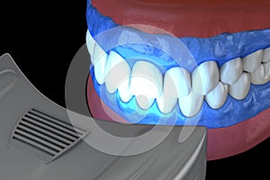Professional teeth whitening. Gel activation lamp. 3D illustration concept