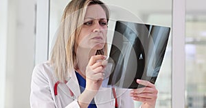 Professional woman doctor examines X-ray image of bones