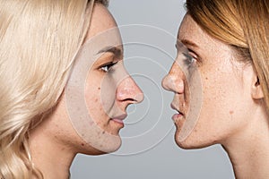 profile of women with problem skin
