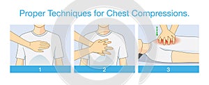 Proper Techniques for Chest Compression.