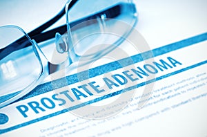Prostate Adenoma. Medicine. 3D Illustration.