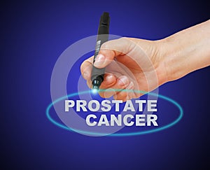 PROSTATE CANCER