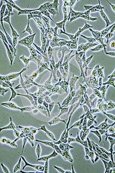 Prostate Cancer cells