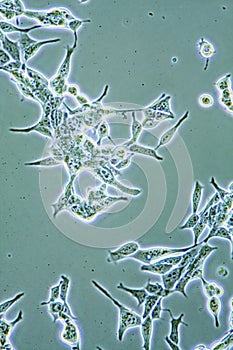 Prostate Cancer cells